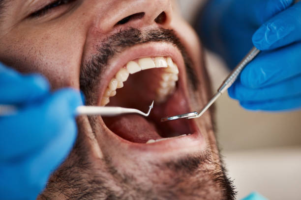Best Emergency Dental Care for Sports Injuries in Springfield, MN